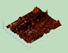 ЭЛЕКТРОННАЯ МИКРОСКОПИЯ  АЛЛОГЕННОГО ГИДРОКСИАПАТИТА